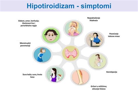 Simptomi hipotiroidizma