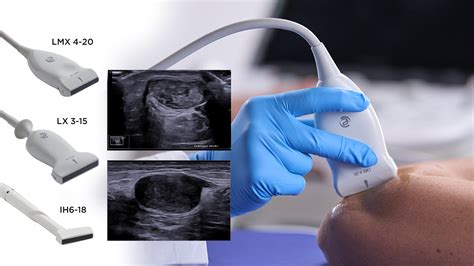 Ultrazvočni aparat pri pregledu nosečnice