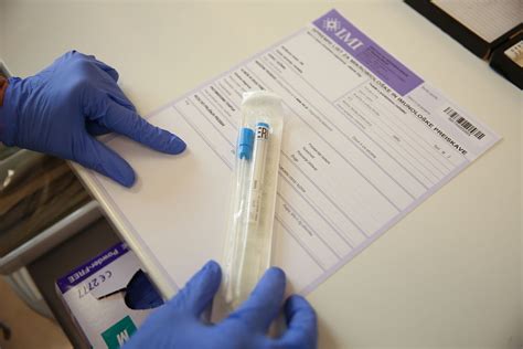 Nosečnica jemlje bris za testiranje Streptokoka skupine B
