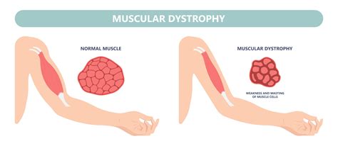 Diagram prikazuje ključne mišične skupine, ki jih krepimo pri vadbi za nosečnice
