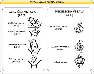 Diagram različnih vrst medenične vstave ploda.