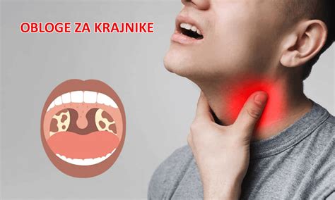 Ilustracija ženske, ki jemlje pastilo za grlo