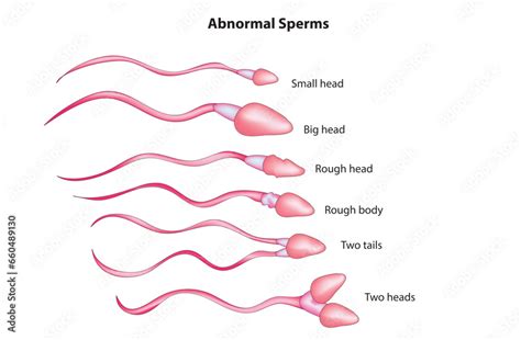 Diagram procesa nastajanja spermijev v moškem reproduktivnem sistemu