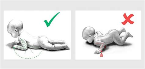 Ilustracija pravilnega podiranja kupčka pri dojenčku