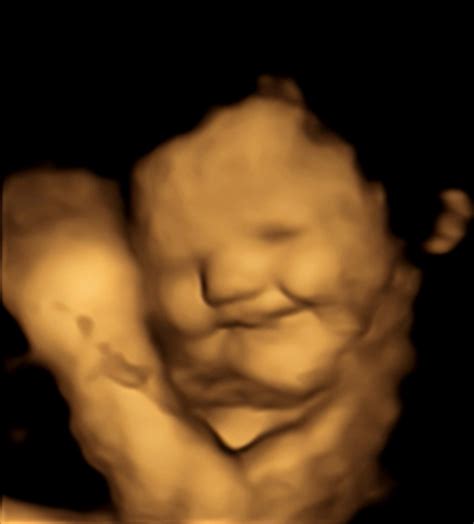 4D ultrazvočni posnetek smejočega se dojenčka v maternici