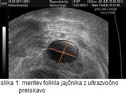 Ultrazvočni prikaz maternične sluznice
