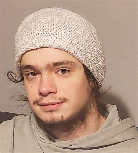 Slika osebe z ognjeno znamenjem na obrazu