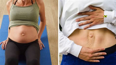 Prikaz telesnih sprememb med nosečnostjo in po porodu