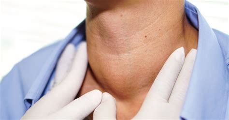 Prikaz ščitnice na vratu