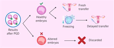 Diagram postopka PGD