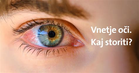 vnetje veke