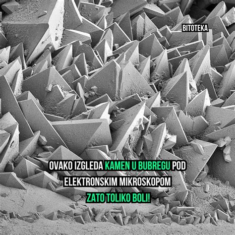 mikroskopski pogled na oplojeno jajčece