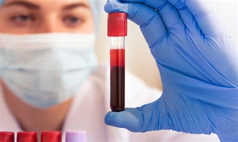 Simbolična slika laboratorijskega delavca, ki analizira vzorec krvi