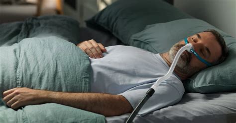 Grafikon, ki prikazuje učinke CPAP terapije na indeks AHI