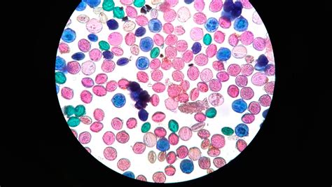 mikroskopski prikaz oplojenega jajčeca