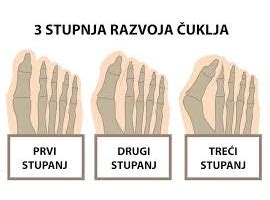 Diagram razvoja otroškega stopala
