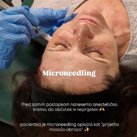 Priprava kože pred injiciranjem z alkoholnim robčkom