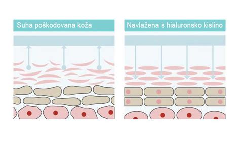 Simbol mladosti: molekula hialuronske kisline