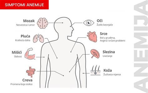 Infografika s prikazanimi simptomi anemije v nosečnosti
