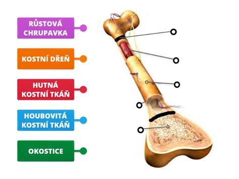 Diagram kosti s poudarjenimi stresnimi zlomi