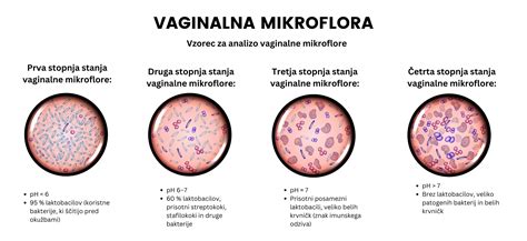 diagram naravnega ravnovesja mikroorganizmov v nožnici