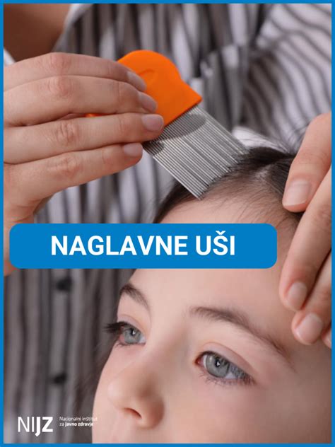 Ilustracija naglavnih uši na lasišču