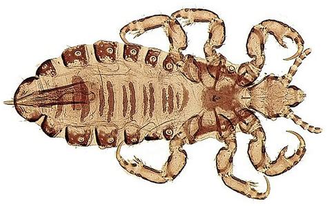 Diagram prikazuje mesta, kjer se uši najraje zadržujejo na glavi