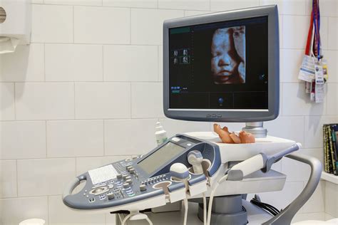 Ultrazvočni posnetek nosečnice z označenim položajem posteljice