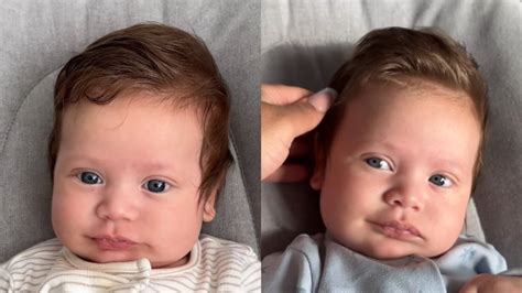 Dojenček s pikastim obrazom