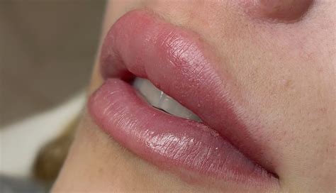 Približna slika polnih ustnic in lepih zob