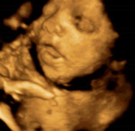 Plod v maternici med ultrazvokom