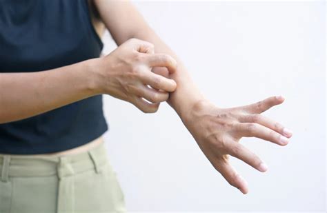 Ilustracija lasnega mešička in vnetja pri turu