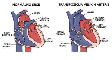 Diagram človeškega srca s poudarjenimi štirimi votlinami: dvema preddvoroma in dvema prekatoma.