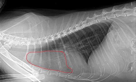 Rentgenska slika hrbtenice z vidnimi spremembami ankilozirajočega spondilitisa.