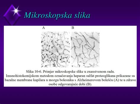 Mikroskopska slika vnetega mišičnega tkiva