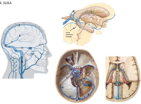 Diagram anatomije nosu z označenimi sinusi