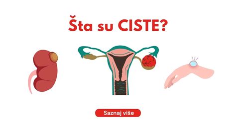 Diagram prikazuje normalno delovanje jajčnika in nastanek ciste