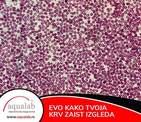 Prikaz krvnih celic pod mikroskopom