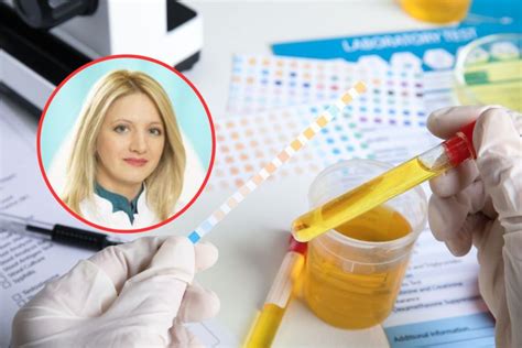 Laboratorijska analiza urina