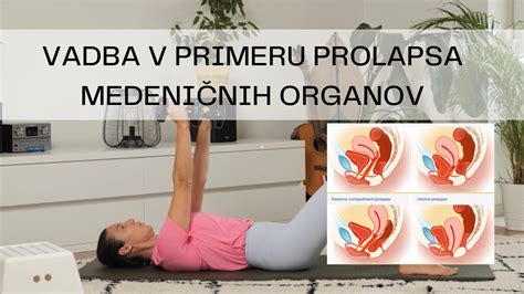 Diagram prolapsa medeničnih organov
