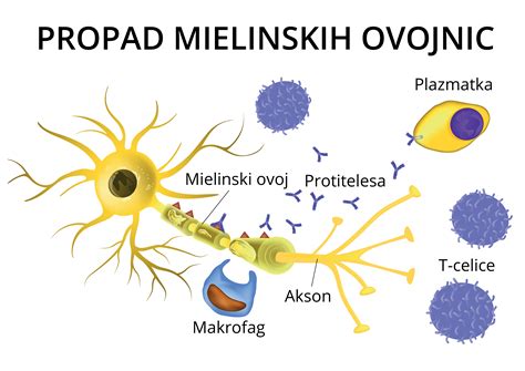 Simbolična upodobitev živčnih celic in mielinske ovojnice