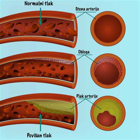 Nosečnica meri krvni tlak