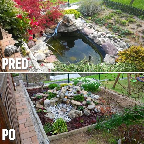 Primerjava pred in po abdominoplastiki