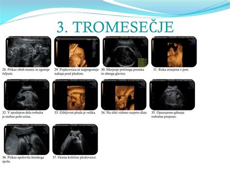 Diagram količine plodovnice skozi nosečnost
