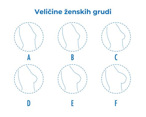 Diagram ženske dojke s poudarjenimi cistami