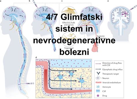 Grafikon, ki prikazuje delovanje nevrotransmiterjev v možganih pri depresiji.