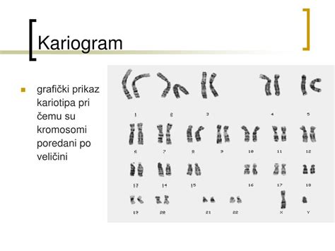 Diagram človeškega kariotipa s poudarjenimi kromosomi