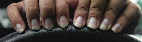 Infografika, ki prikazuje različne spremembe na nohtih in njihove možne vzroke