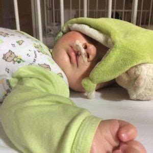 dehidriran otrok s suhimi ustnicami