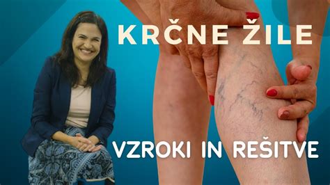 Vizualizacija krčnih žil na nogah